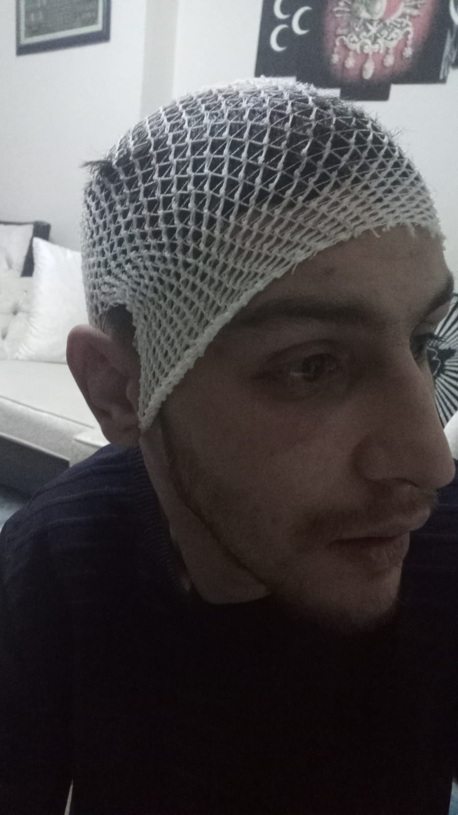 İŞ ARAYAN SARA HASTASI GENCİ HEM DARP ETTİLER HEMDE GASP ETTİLER