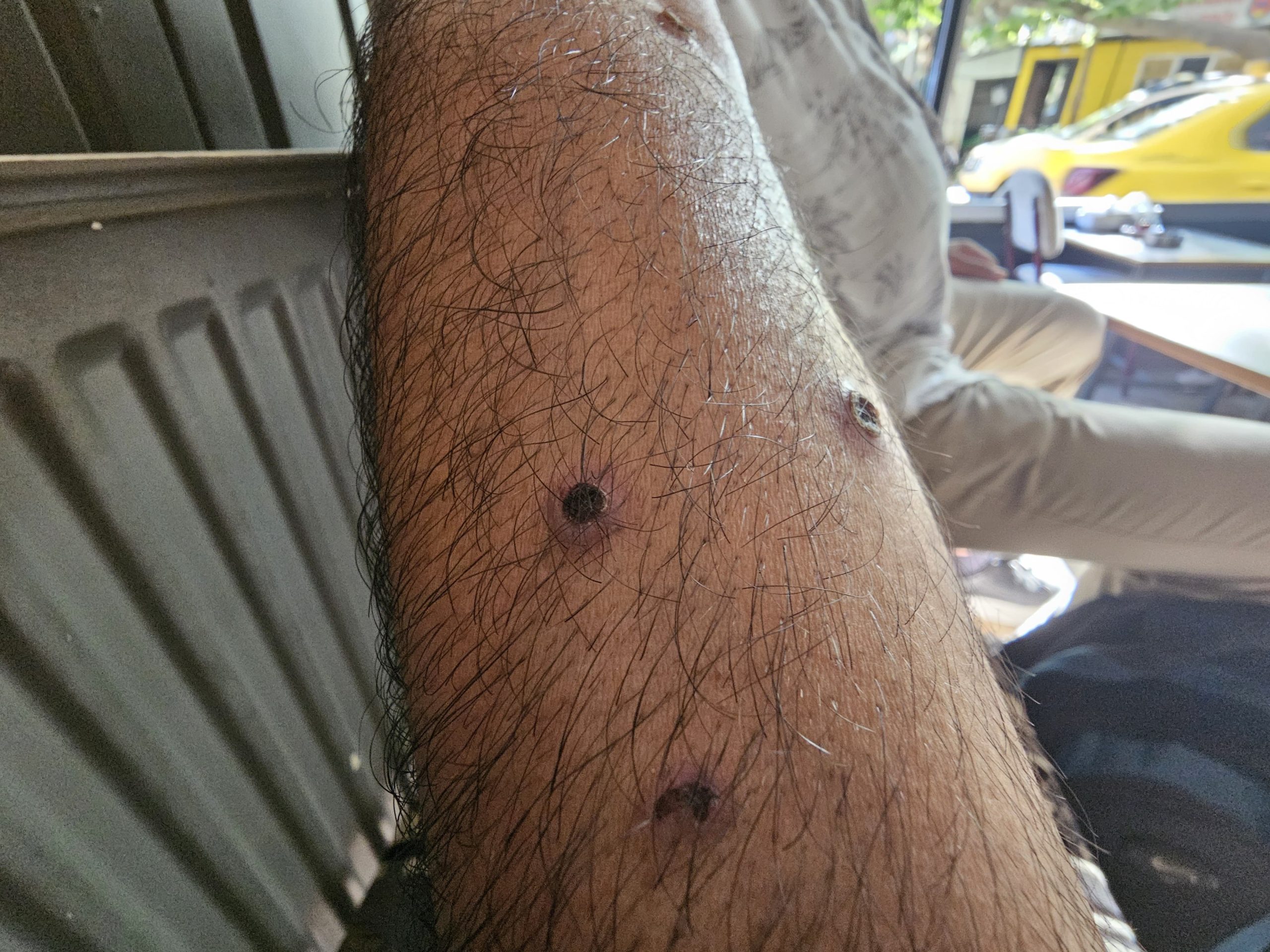 Berberin ‘Ben İlacı’ Vaadi Vatandaşı Mağdur Etti