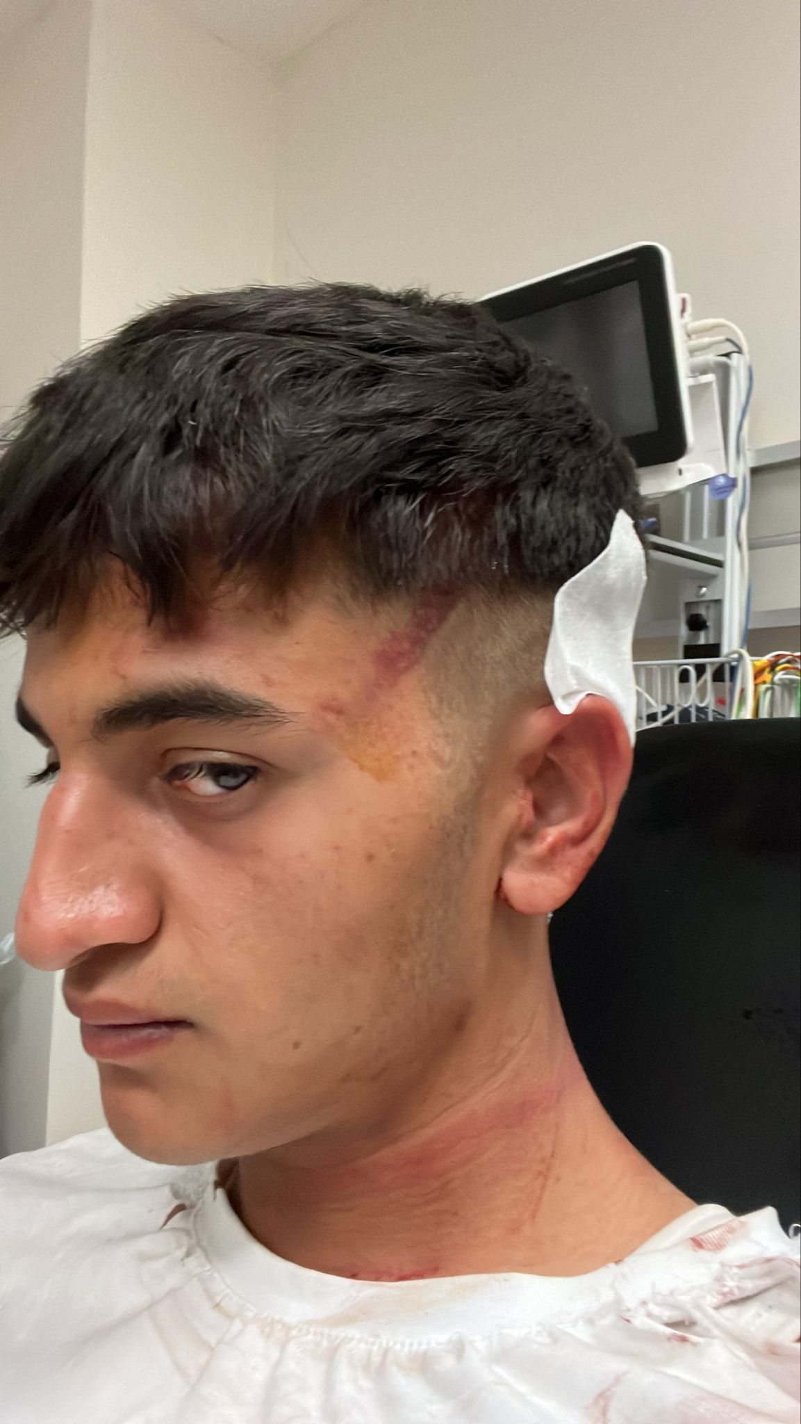 Keban’da Su Festivali’nin final gecesi, büyük bir skandalla gölgelendi.