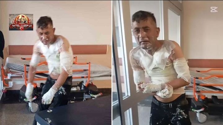 Engelli vatandaşı benzin döküp yakan vicdansıza verilen ceza belli oldu