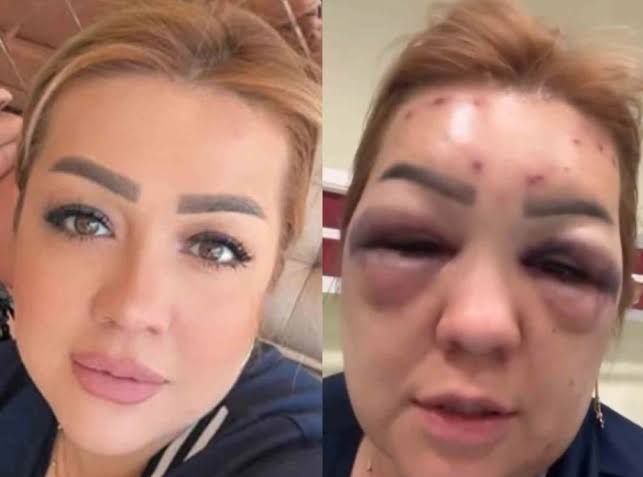 Elazığ’da Botoks yaptırmak isteyen genç kadın kabusu yaşadı!